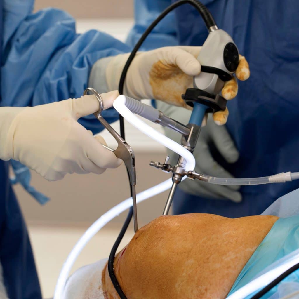 Knee Surgery