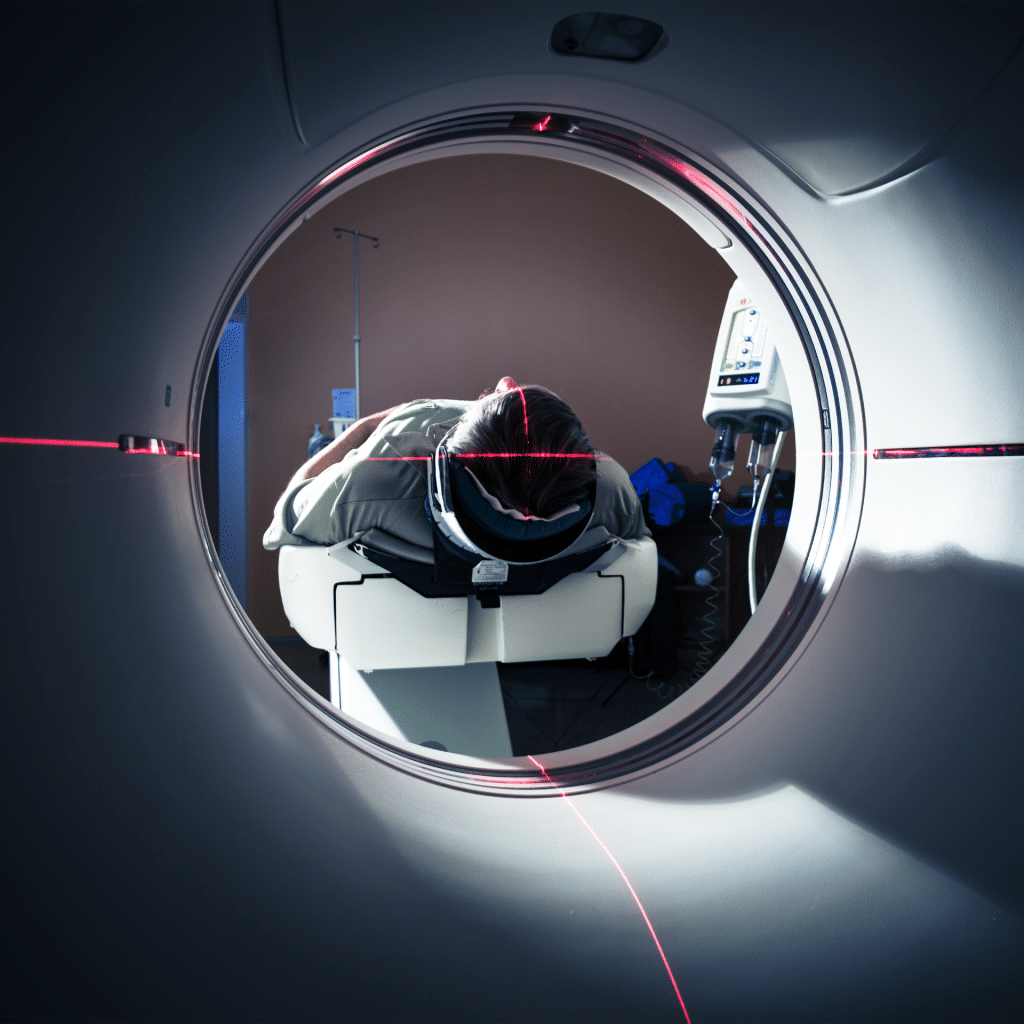 cat scan