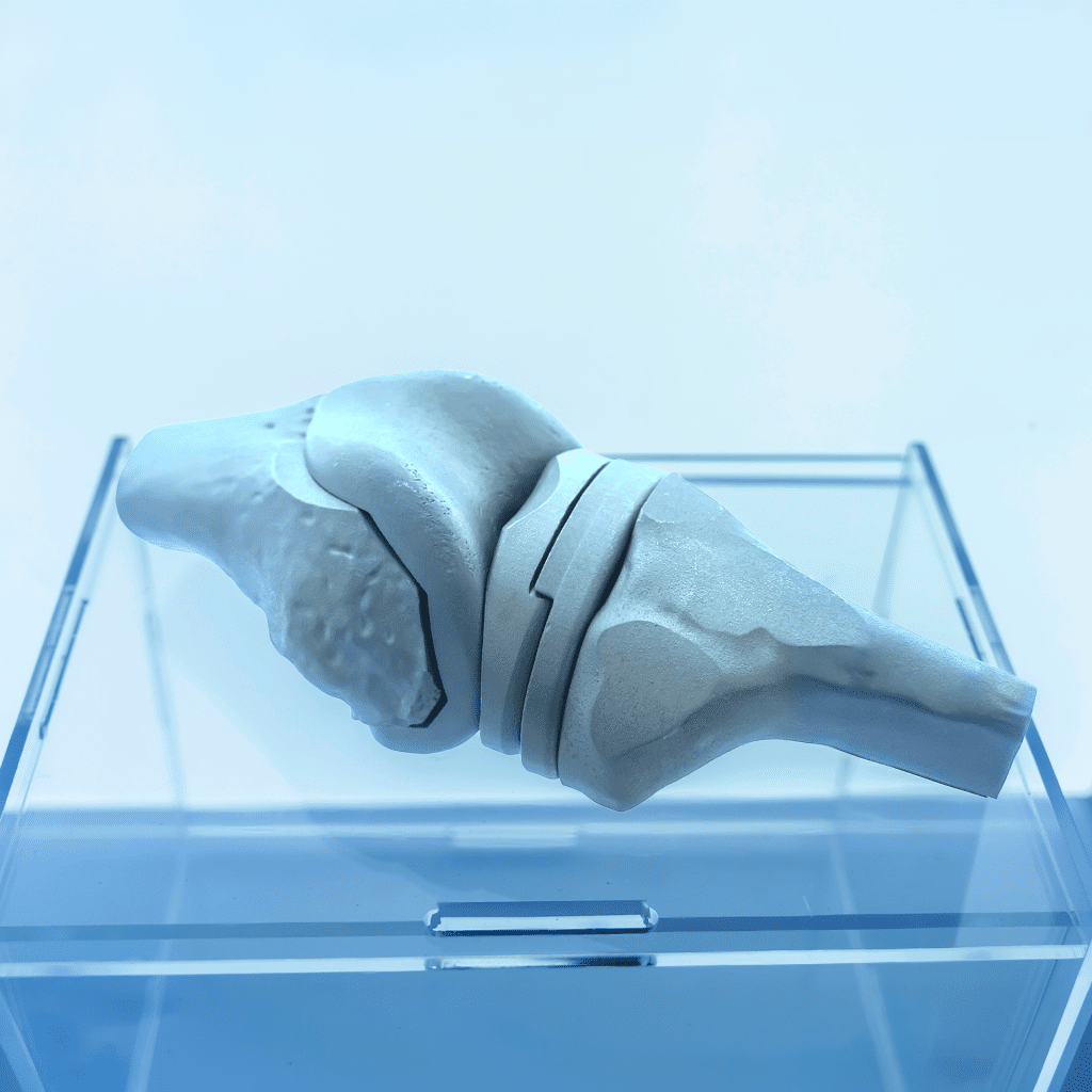 knee implant 2